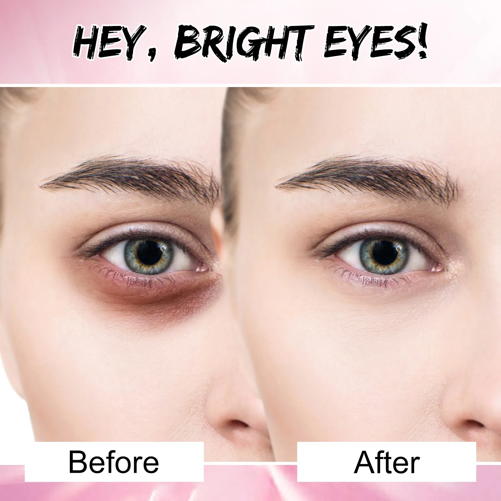 Aliver Hydrogel Eye Patch 100 pcs